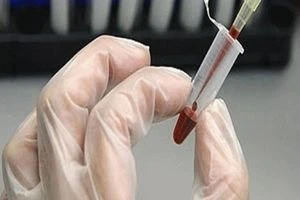 شركة ايرانية تنجح في تصنيع أجهزة طرد مركزي متطورة خاصة بالدم