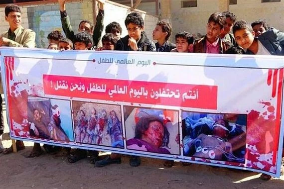 أطفال اليمن يحيون اليوم العالمي للطفل تحت وطأة العدوان والحصار