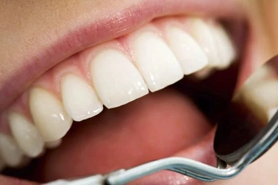 دراسة امريكية ..إهمال صحة الأسنان يسبب أمراض جسدية وعقلية