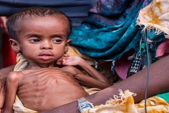 الجفاف يدفع الصومال نحو “مجاعة كارثية”