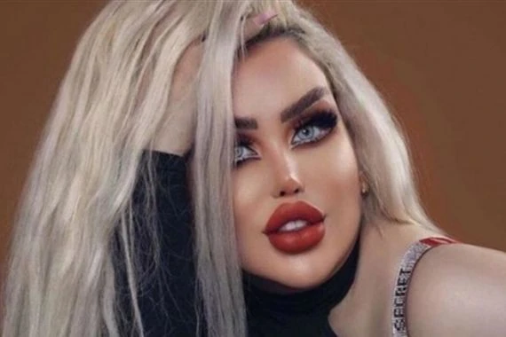 داليا نعيم تكشف عدد عمليات التجميل التي خضعت لها