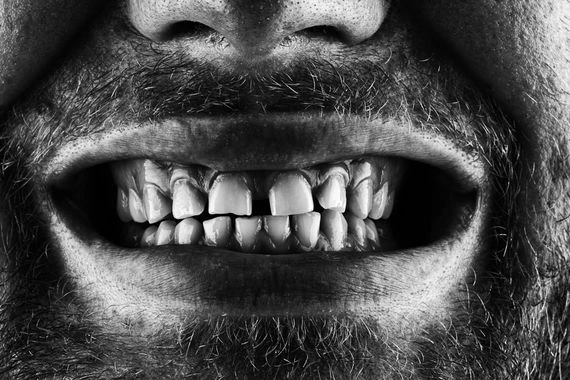 للأسنان بصمة مثل الأصابع.. كيف استطاعت الأسنان أن تحل أكثر الجرائم غموضاً؟