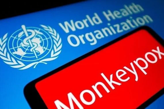 الصحة العالمية توضح حول إلغاء المهرجانات بأوروبا بظل تفشي جدري القردة